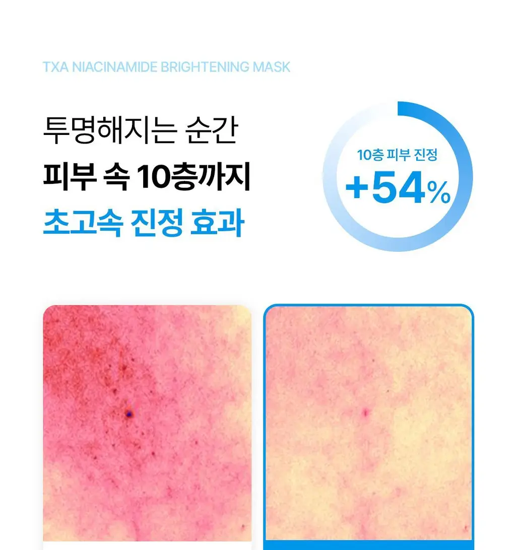 프롬메디 마스크 3종 [아줄렌 시카/콜라겐 멜팅/TXA 브라이트닝] 4매입 상세페이지 24